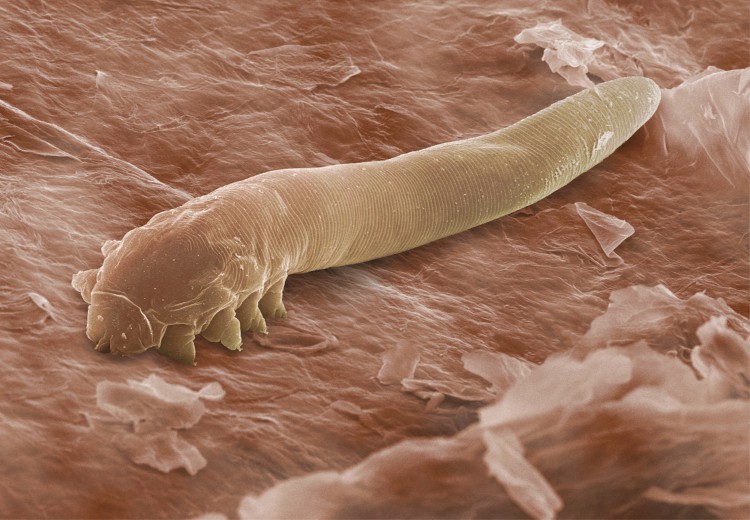 These mites are likely on your face right now!