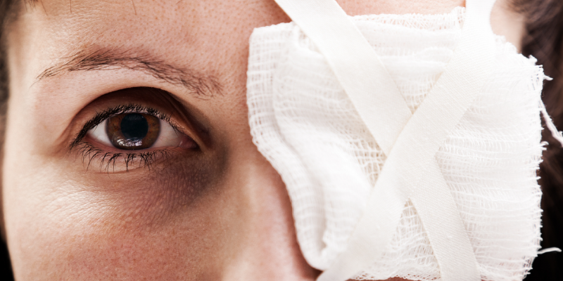The 5 Most Common Eye Injuries
