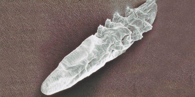 Demodex brevis: Treatments and prevention