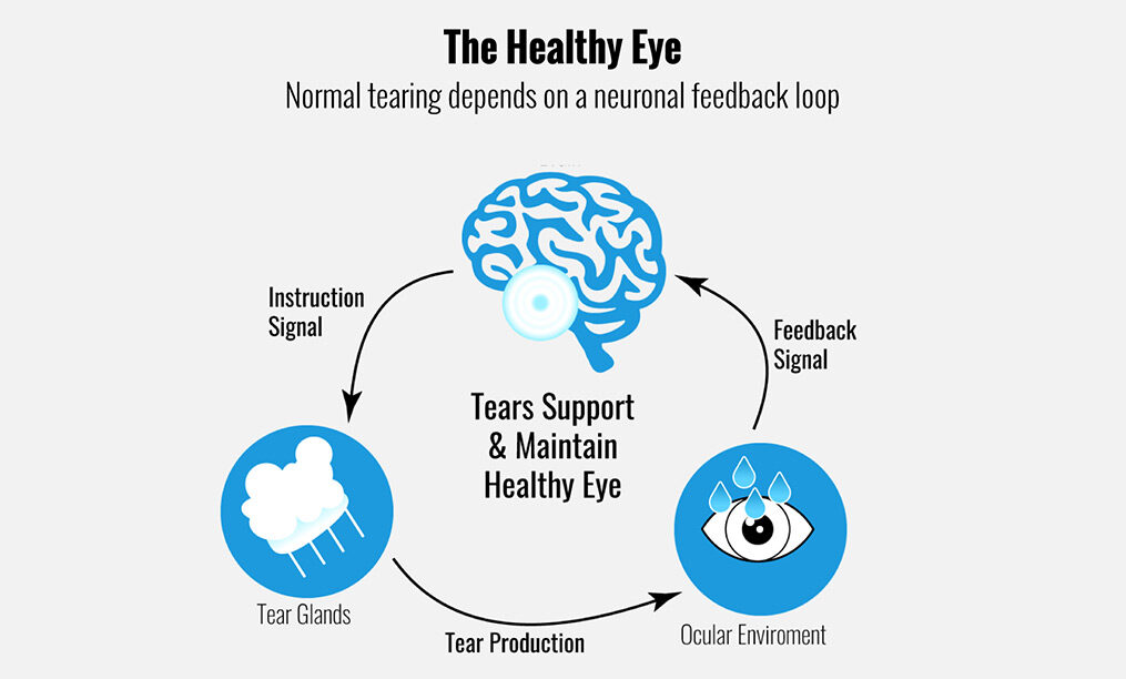 What Is Dry Eyes Symptoms Causes And Treatment Cliradex 